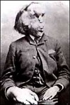 JOSEPH MERRICK